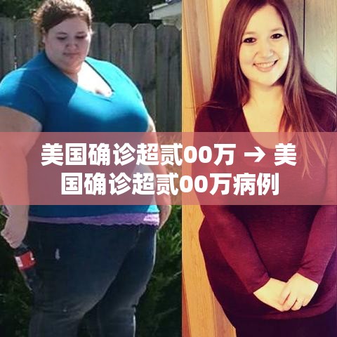 美国确诊超贰00万 → 美国确诊超贰00万病例 美国确诊超贰00万 → 美国确诊超贰00万病例