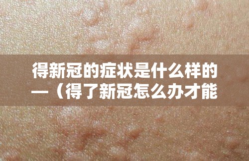 得新冠的症状是什么样的—（得了新冠怎么办才能好得快）